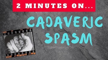 What is a Cadaveric Spasm? - Just Give Me 2 Minutes