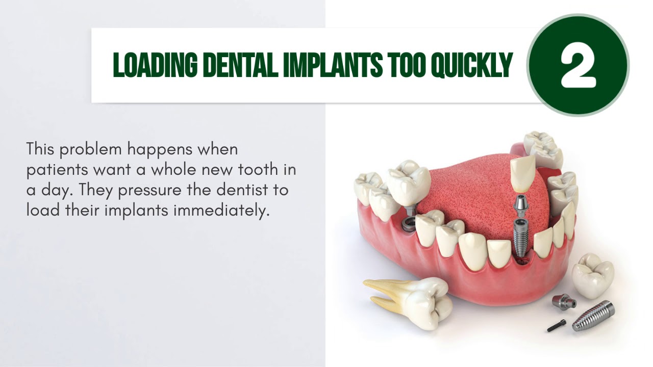 The Factors Behind Dental Implant Failure YouTube