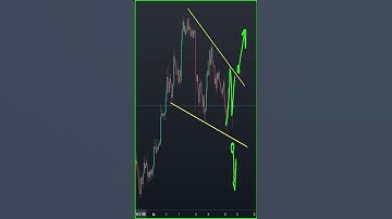Ethereum price prediction #ethereumtoday  #ethereum #eth #shorts #altcoinbitcoin