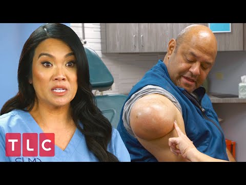 A Weight Off His Shoulder | Dr. Pimple Popper (Extended)