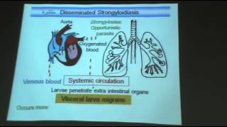 bél strongyloidosis
