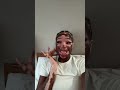 Honestly. | #vitiligo #explore #explorepage #shortsfeed