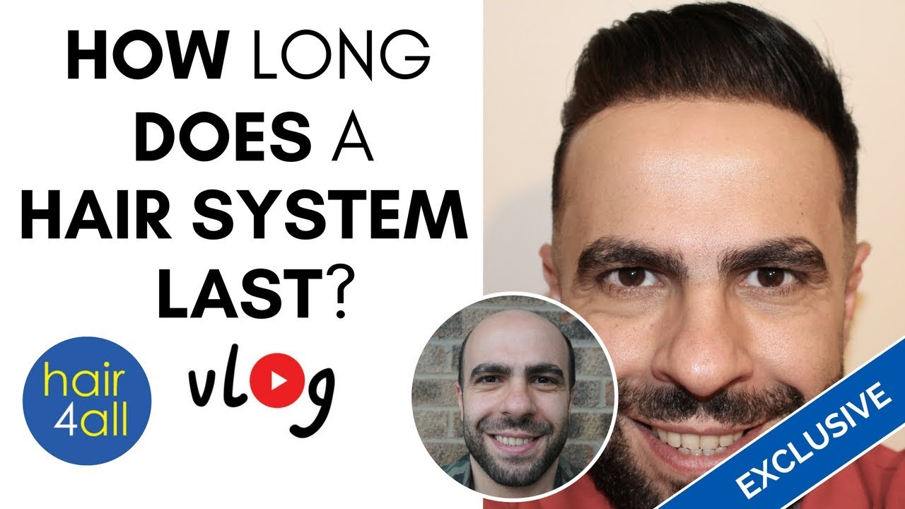 How Long Does a Hair System Last? | Non-Surgical Hair Replacement System  for Men/Women - YouTube