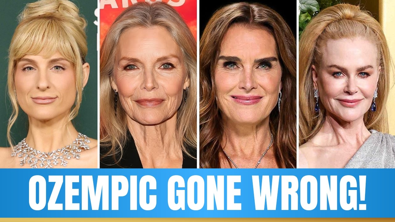 ШОКИРУЮЩИЕ трансформации лиц знаменитостей в 2026 году, которые имели обратный эффект — тогда и с...