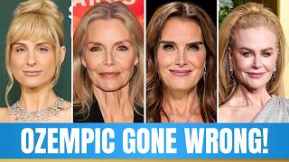 Famous SHOCKING Celebrity OZEMPIC Face Transformations of 2026 That Backfired - Then and Now 2026 Profile