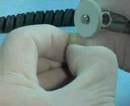 Hand Polishing CEREC and lab-made restorations