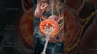 CYSTITIS: What’s REALLY Happening Inside Your Bladder? 😳