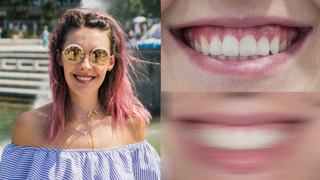 MEU SORRISO MUDOU? - Karen Bachini - YouTube