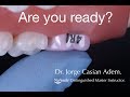 NuSmile Permanent Molar Crown. Hands-on Workshop by Jorge Casián