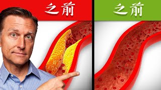 清除血管阻塞、血管內斑塊的最佳營養素,自然療法,柏格醫生 Dr Berg