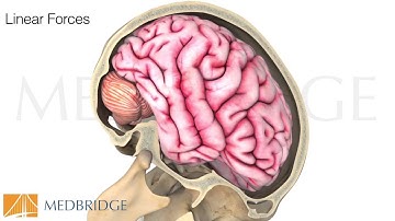 Concussion- Assessment, Screening, & Risk Factors Video: Anne Mucha & Susan Whitney | MedBridge