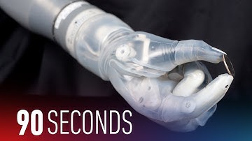 This mind-controlled arm is the future of prosthetics: 90 Seconds on The Verge