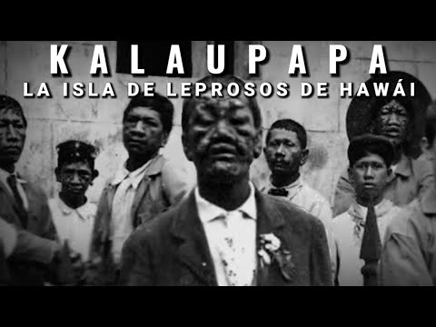 Video: ¿Kauai era una colonia de leprosos?