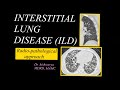 Interstitial lung diseases radiopathology l hrct chest l approach to diagnosis l treatment l