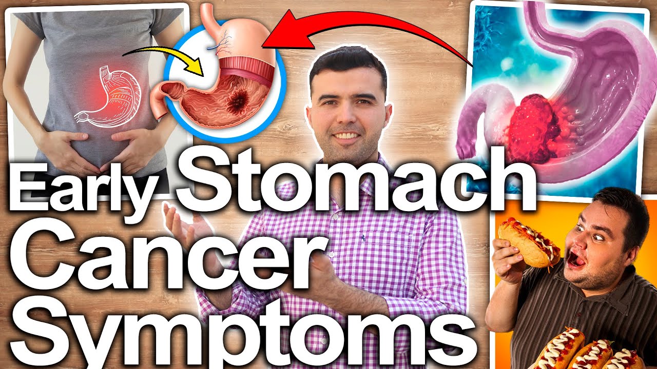 EARLY SIGNS OF STOMACH CANCER - You Should NOT IGNORE EVERY SYMPTOM OF STOMACH CANCER