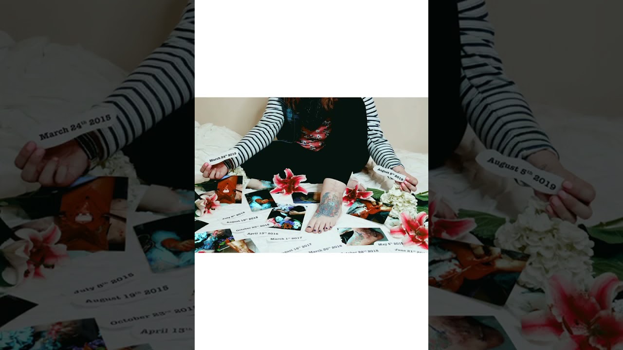 The Road to Recovery: Overcoming Phantom Pain After Reconstructive Below Knee Amputation