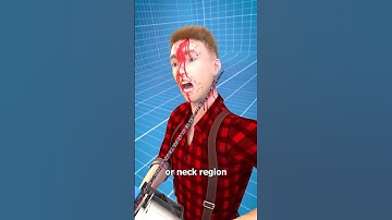 Thumbnail of How Chainsaw Kickback Works