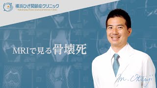 ひざの痛みの原因は?時間が経って悪化した膝の症状 ひざの痛みの原因は?時間が経って悪化した膝の症状