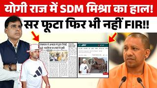 सर फूटा, 6 दिन बीते, फिर भी नहीं FIR, Yogi राज में SDM Mishra का हाल!!