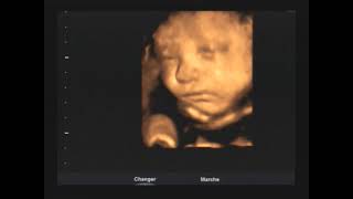 Baby smiling inside the womb 🥰 30 weeks 3D/4D ultrasound