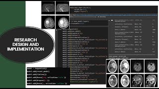 Technical Demo for Research on Brain Stroke Classification using Neural Networks.