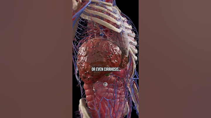 LIVER DISEASE And The Carnivore Diet! 👉