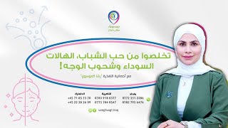 تخلصوا من حب الشباب، الهالات السوداء وشحوب الوجه! مع أخصائية التغذية رشا الموسوي