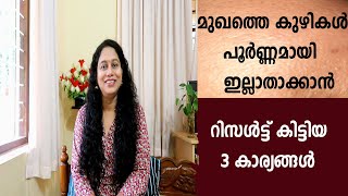 മുഖത്തെ കുഴികളും പാടുകളും എളുപ്പത്തിൽ മാറ്റാം Home remedy for Open Pores