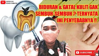 BIDURAN & GATAL GAK SEMBUH-SEMBUH ⁉️ INI PENYEBABNYA & CARA MENANGANINYA #biduran #gatal