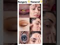 👉Eye Bags... Natural or Procedure? 👀 Look Closely
