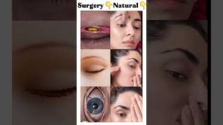 👉Eye Bags… Natural or Procedure? 👀 Look Closely