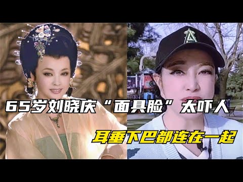 65岁刘晓庆“面具脸”吓人，耳垂下巴都连在一起，能不能真实点