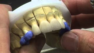Ceramic build up