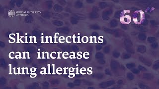 60 Seconds Of Science Skin Infections Can Increase Lung Allergies