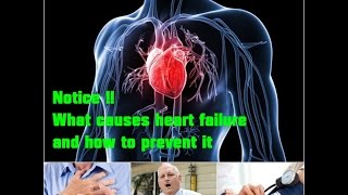 Notice !! What causes heart failure and how to prevent it