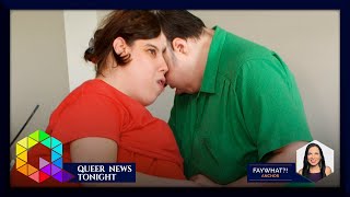 A Tribute To Late Conjoined Twins Lori and Trans George Schappell