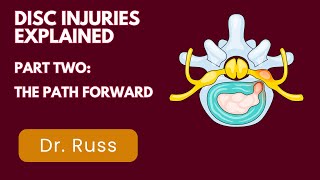 Herniated Disc Recovery: What Actually Heals You (Part 2 of 3)Updated Disc part 2 2