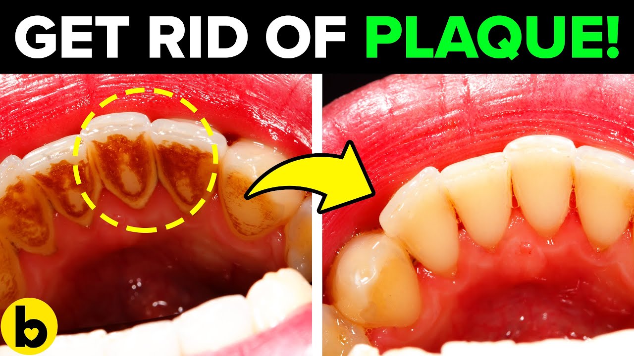 This DIY Mouthwash Gets Rid Of Bad Breath & Plaque YouTube