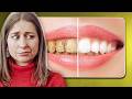 Blanchiment des dents : ce qui fonctionne vraiment (et ce qu’il faut éviter)