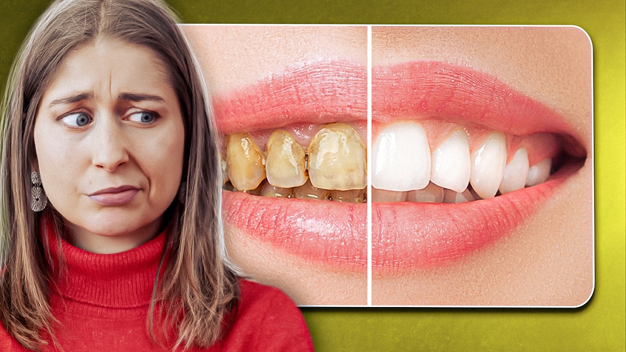 Blanchiment des dents : ce qui fonctionne vraiment (et ce qu’il faut éviter)