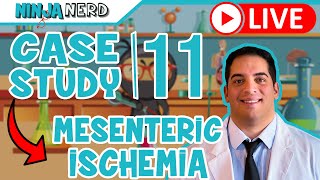 Case Study #11: Acute Mesenteric Ischemia
