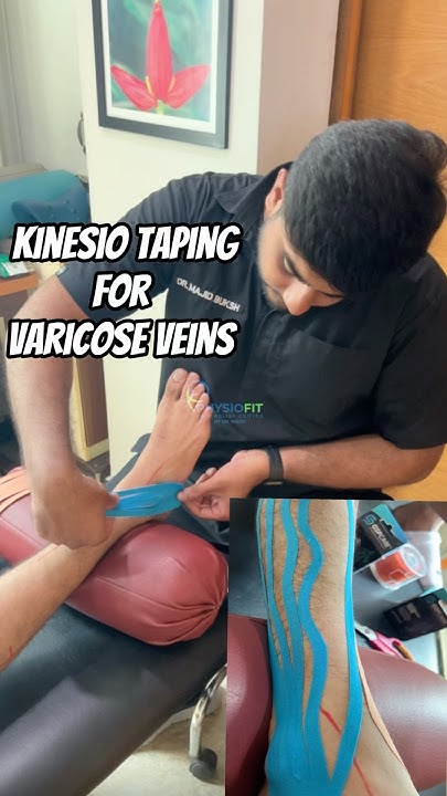 Can Kinesio Tape Help Varicose Veins 🌟Kinesio Taping For varicose Veins #physiofit #kinesiotaping #