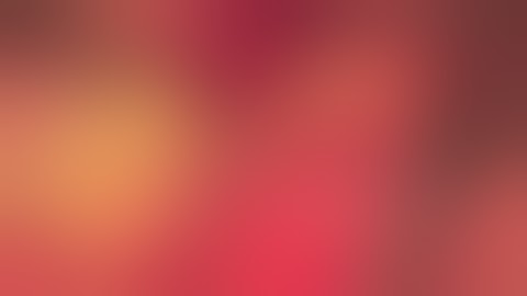 VERTICAL BONE AUGMENTATION IN THE POSTERIOR MANDIBLE  DR LUCA DE STAVOLA   www admadent com