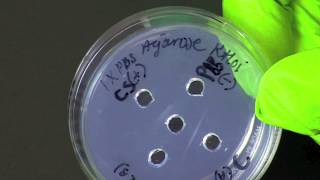 How To Perform An Ouchterlony Assay (Double Immunodiffusion Assay)