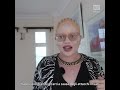 Essere una persona albina in Kenya #shorts | RSI Info