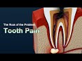 Causes of severe toothache and how to relieve the pain