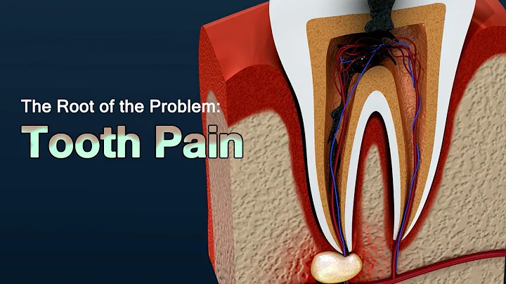 Causes of Severe Toothache and How to Relieve the Pain - DayDayNews