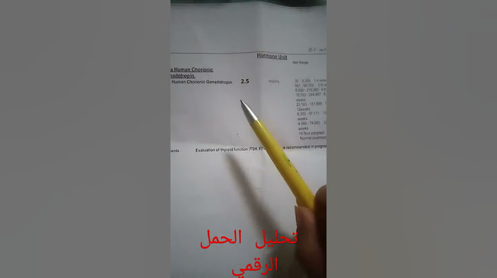 تحليل الحمل الرقمي