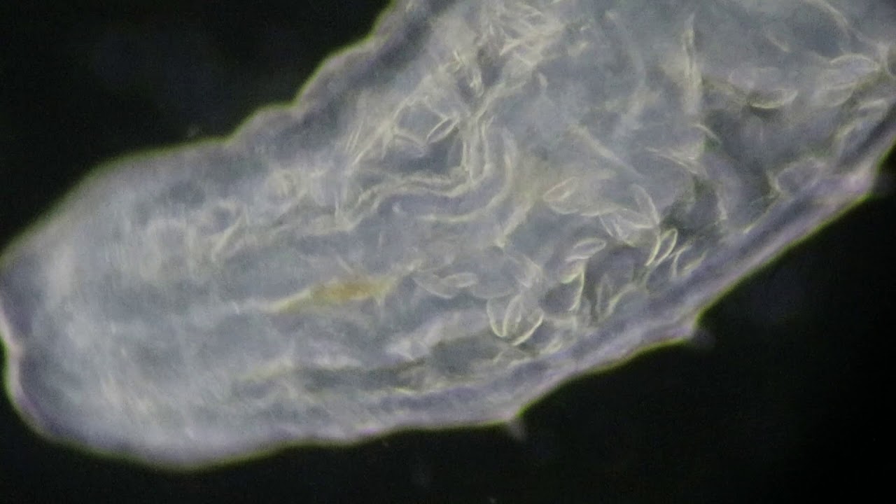 tapeworm under a microscope