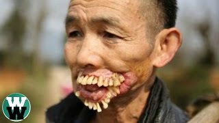 15 Horrible Diseases With No Cure